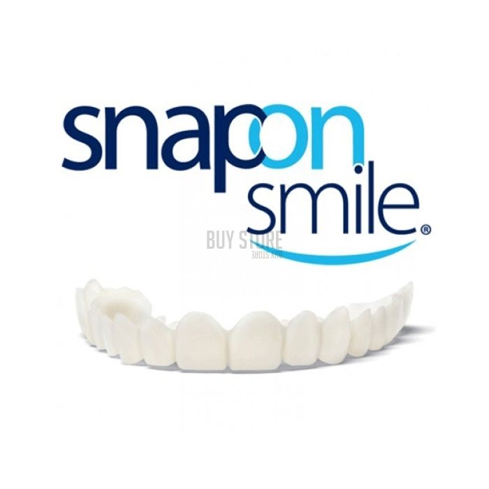 Snap-On Smile - veneers